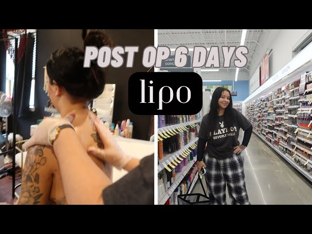 VLOG: Post Op 6 days and ranting about my mental health!