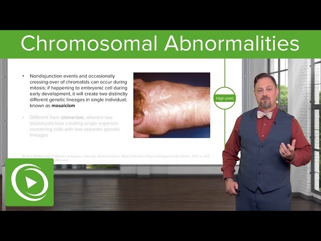 Chromosomal Abnormalities: Turner, Klinefelter & Rett Syndrome, Trisomy etc. – Embryology | Lecturio