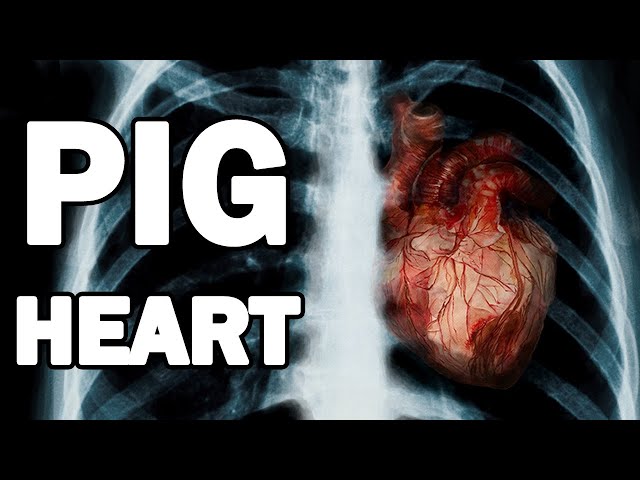 The Odd Story behind the Pig-to-Human Transplant (Xenotransplantation)