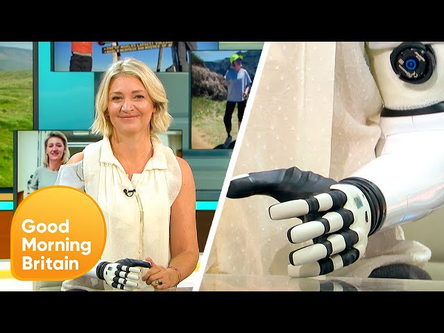 The Bionic Woman: 80% Human 20% Robot After Horror Fall | Good Morning Britain