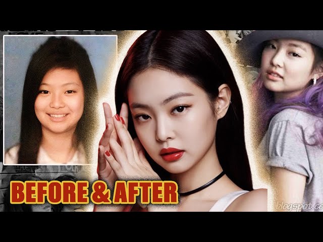 BlackPink Jennie Kim: Plastic Surgery (2016-2020) - Lifting The Veil