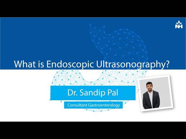 Endoscopic Ultrasonography | Dr. Sandip Pal