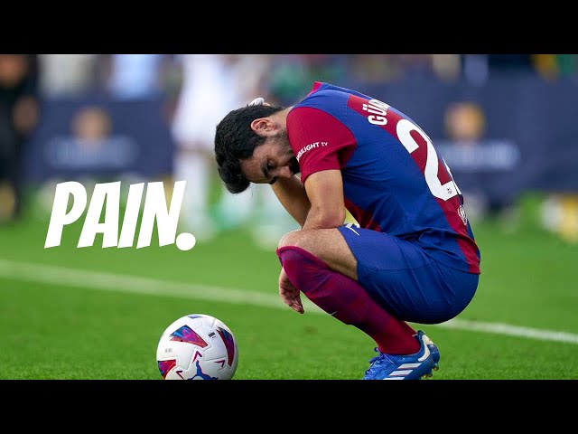 El Clasico Gives Me Pain