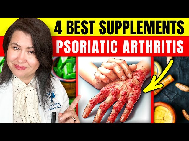BEST 4 Supplements for Psoriasis & Psoriatic Arthritis + Bonus Tips!
