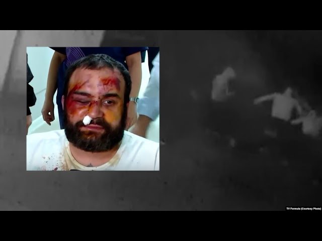 Georgian Opposition Members Were Beaten Amid Government Crackdown Over "Foreign Agent" Bill Protests