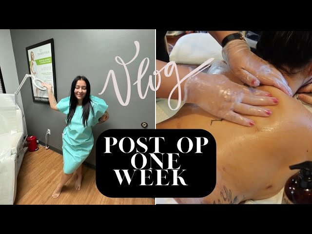 VLOG: One week post op Lipo appointment!