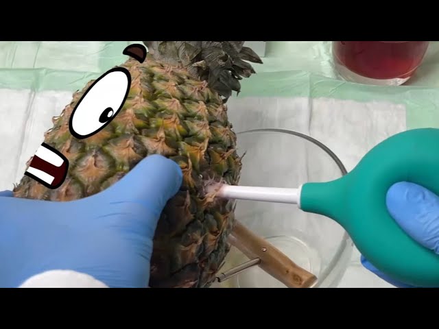 Fruitsurgery (WORLD OF DOODLES) | Pineapple needs surgical operation | Funny video with Doodles