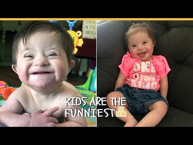 Baby With Down Syndrome Shows Off 'New Smile' After Adoption
