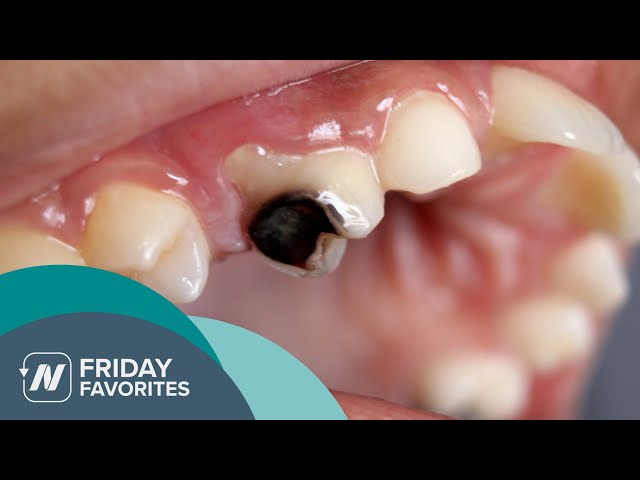 Friday Favorites: How to Stop Tooth Decay