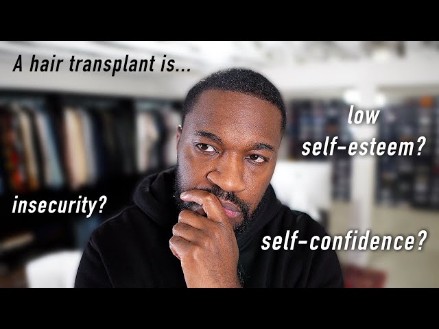 Why Get a Hair Transplant?!?! …Insecurity? Low Confidence? Low Self-Esteem? | I AM RIO P.