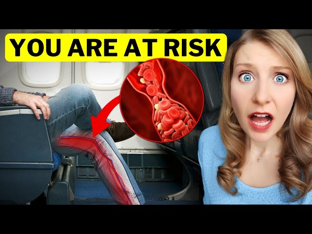 Proven Method to Avoid Blood Clots | (risk DOUBLES when you fly!)