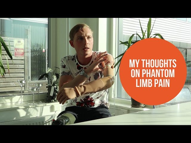 How I feel and handle phantom limb pain – tips for amputees