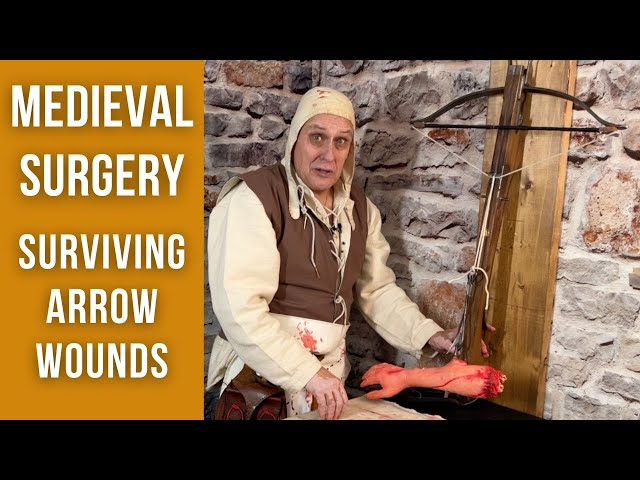 Medieval Surgery | Arrow Removal Techniques