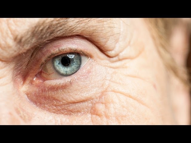Eye scanning to help identify and treat symptoms in Alzheimer's