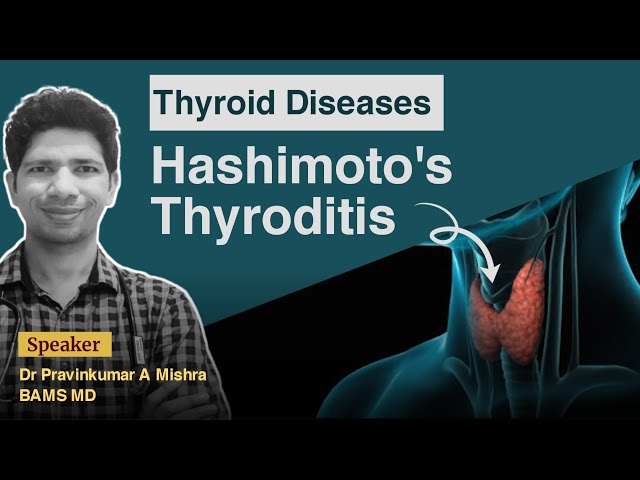 Hashimoto's Thyroditis and it's scope in Ayurved