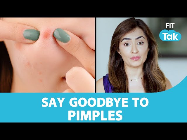 Acne-Prone Skin | How to Get Rid of Pimples? | Face Yoga By Vibhuti Arora | Fit Tak