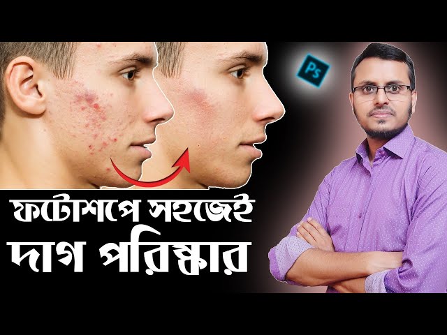 Quickly clean your face in Photoshop | Remove pimples, blemishes, acne easily