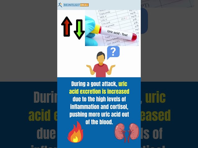 Uric Acid Test During a Gout attack?