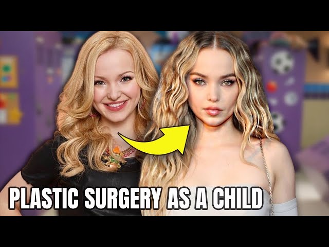 Dove Cameron's Plastic Surgery; started YOUNG