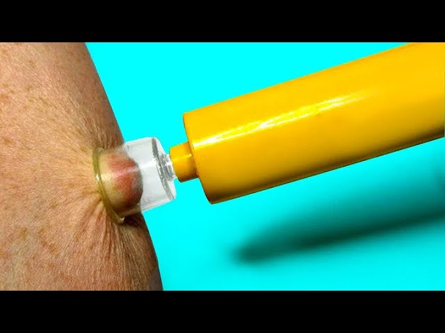15 LIFE SAVING Inventions You Need To See!