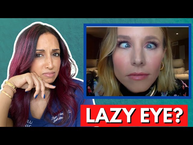 Does Kristen Bell Have A Lazy Eye? Eye Doctor Explains