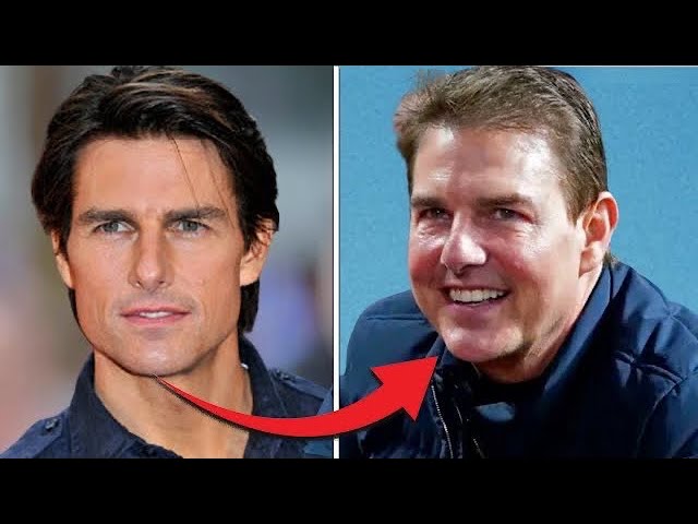Tom Cruise Plastic Surgery: FULL FACE Reconstruction YOU Didn't Notice