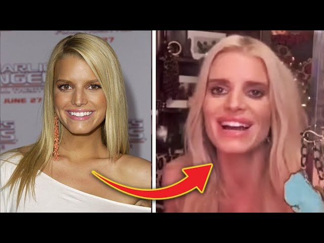 Jessica Simpson's Face Looks WILDY Different: WEIGHT LOSS or Plastic Surgery?
