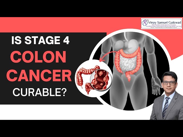 Is Stage 4 colon cancer curable? #coloncancer | Dr. Vinay Samuel Gaikwad - Surgical Oncologist