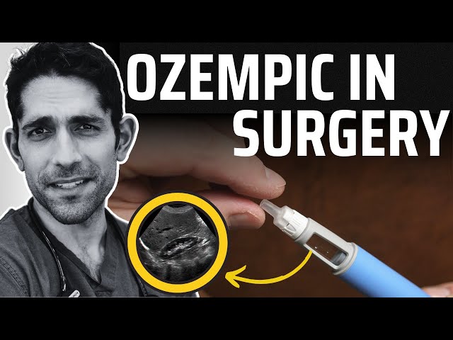 Deadly Ozempic Side Effect In Surgery