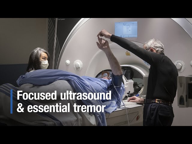 New clinical trial at Sunnybrook for bilateral essential tremor treatment with focused ultrasound
