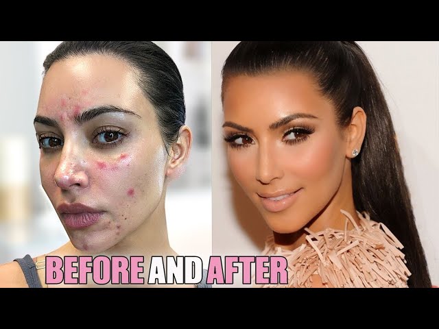 Kim Kardashian: Skin Procedures (2021) - She Spends ___?
