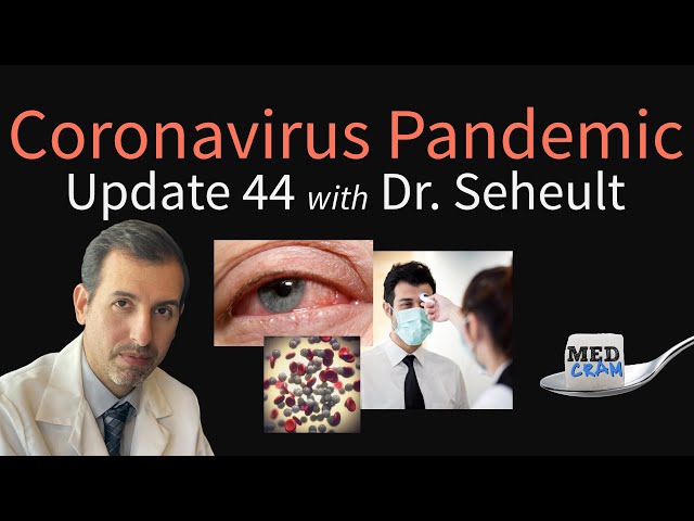 Coronavirus Pandemic Update 44: Loss of Smell & Conjunctivitis in COVID-19, Is Fever Helpful?