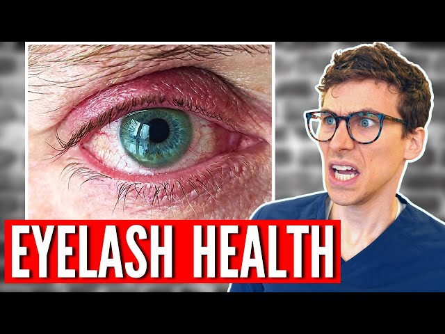 Why You NEED to Wash Your EYELASHES - 5 Tips for Blepharitis