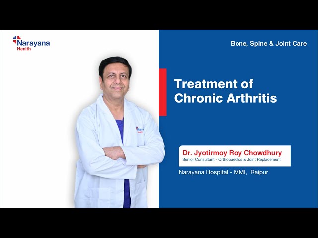 Arthritis Management Tips By Dr Jyotirmoy Roy Chowdhury