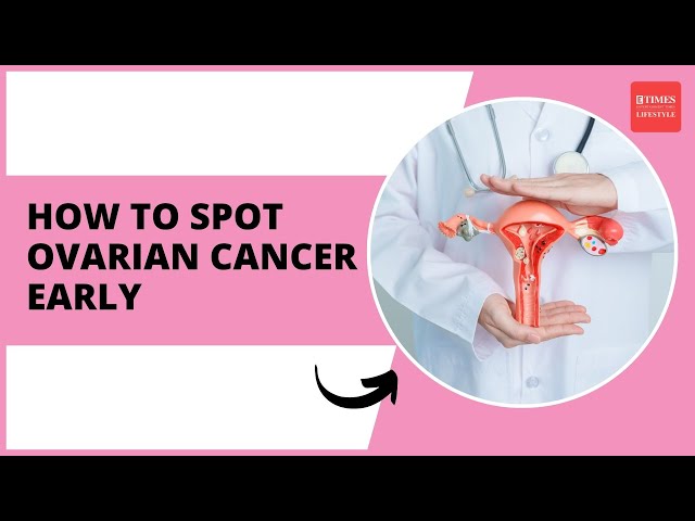 Early Warning Signs of Ovarian Cancer: Don't Ignore These! Doctor Reveals