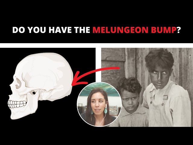 5 Common Traits of Melungeon Descent?
