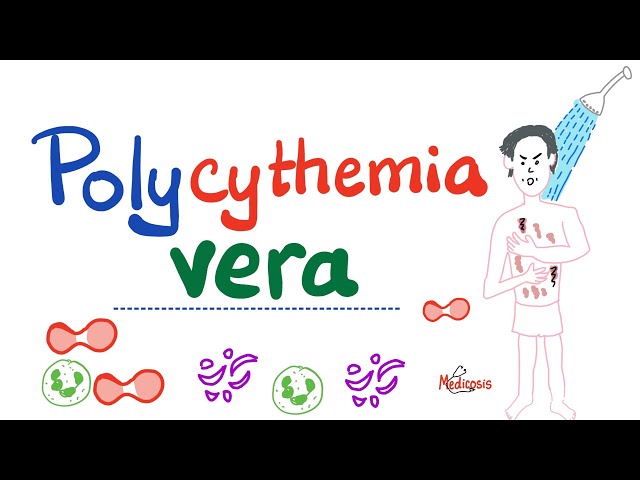 Polycythemia Vera (PV) | Myeloproliferative Neoplasm (MPN) | Erythrocytosis