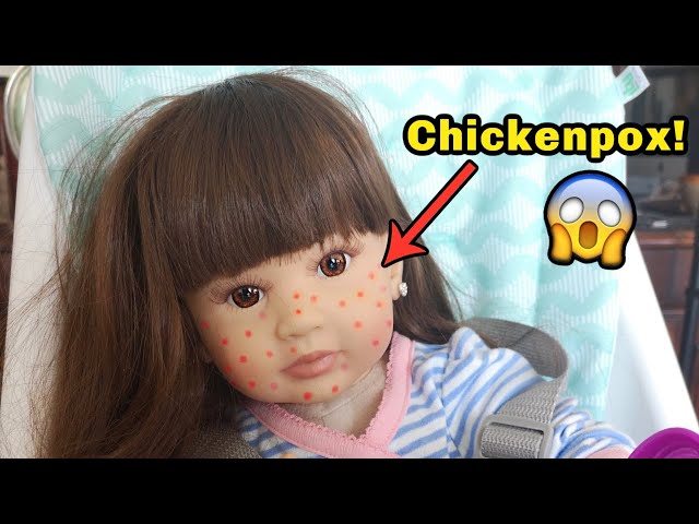 Reborn Toddler Lizzy Has Chickenpox Roleplay