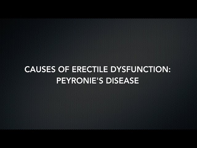 Causes of Erectile Dysfunction: Peyronie's Disease