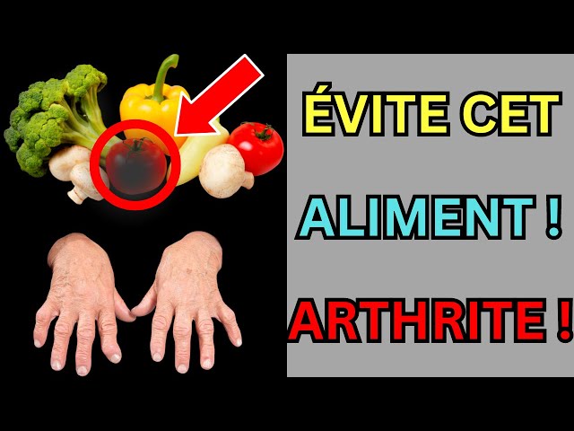 STOP 🛑 Arthrite : 7 Aliments à BANNIR de votre Assiette !