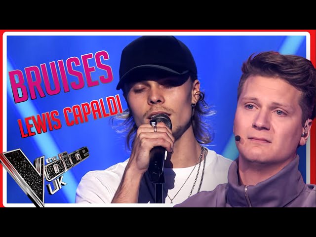 NORWEGIAN GUY SINGS LEWIS CAPALDI WITH PURE EMOTION & LEAVES JUDGES IN TEARS ON THE VOICE 2021!