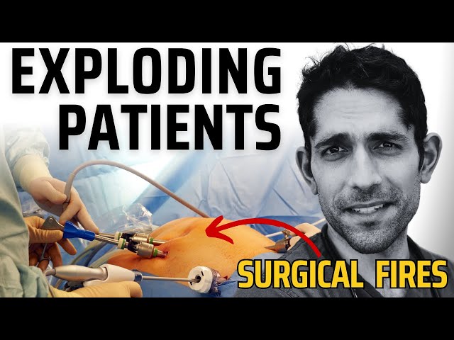 Kaboom in the Operating Room 💥 patients catching on fire in surgery