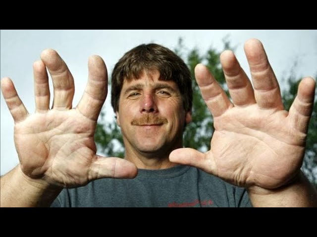 The Biggest Hands In The World