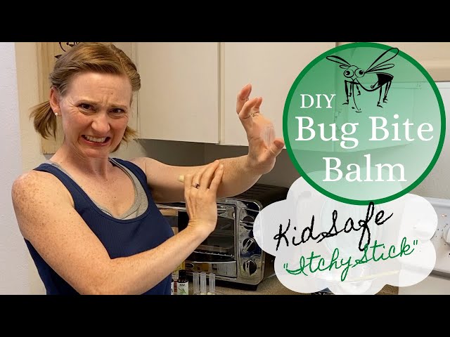 DIY Bug Bite Balm - Kid Safe "Itchy Stick"