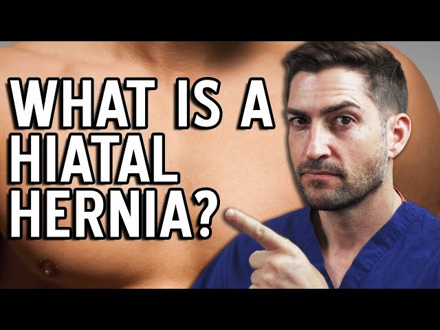 Hiatal Hernia - All 4 Types Explained!