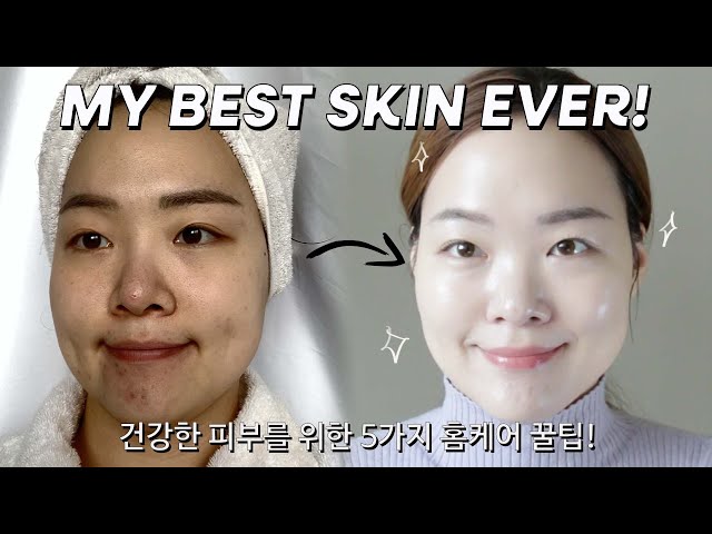 5 at-home skincare tips to really improve your skin! | MY BEST SKIN EVER!