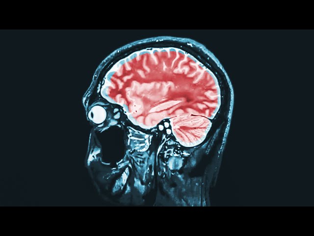A Grandma Ate 1 Pound Chocolate In 6 Hours. This Is What Happened To Her Brain.