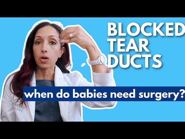 Blocked Tear Duct Surgery For Babies | Peds Eye Doctor Explains