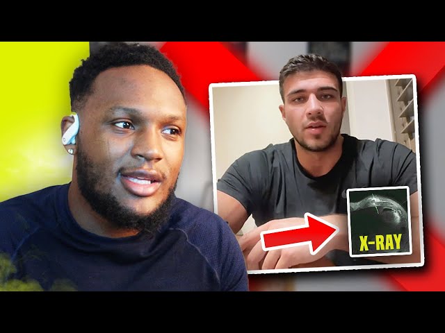 Reacting To Tommy Fury PULLING OUT Against Jake Paul.