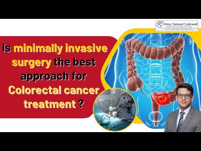 Minimally Invasive Surgery for Colorectal Cancer - Dr. Vinay Samuel Gaikwad  #cancertreatment